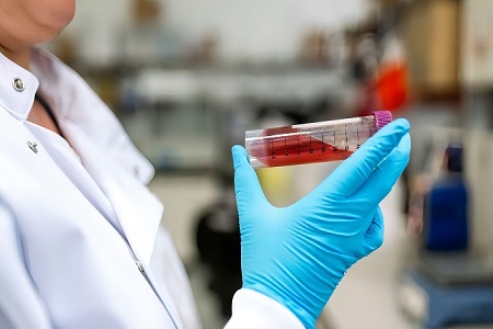 食品媒介性疾患の症例の世界的な急増は、信頼できる輸送メディアの重要性を強調しています - バビオの修正されたキャリーブレア輸送メディアは世界的な注目を集めています