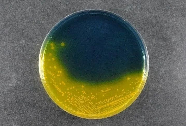 食品の安全性の確保：バビオのサルモネラシゲラ寒天（SS）は世界の病原体検出基準をサポートしています