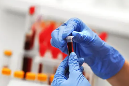 マラリアの迅速検出: BABIO の二重抗原検査キットが世界の健康を支援