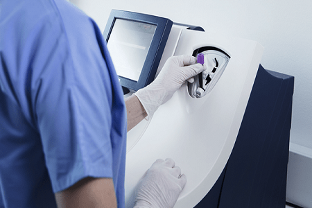 BABIO のプロカルシトニン (PCT) テストカードによる迅速な検出